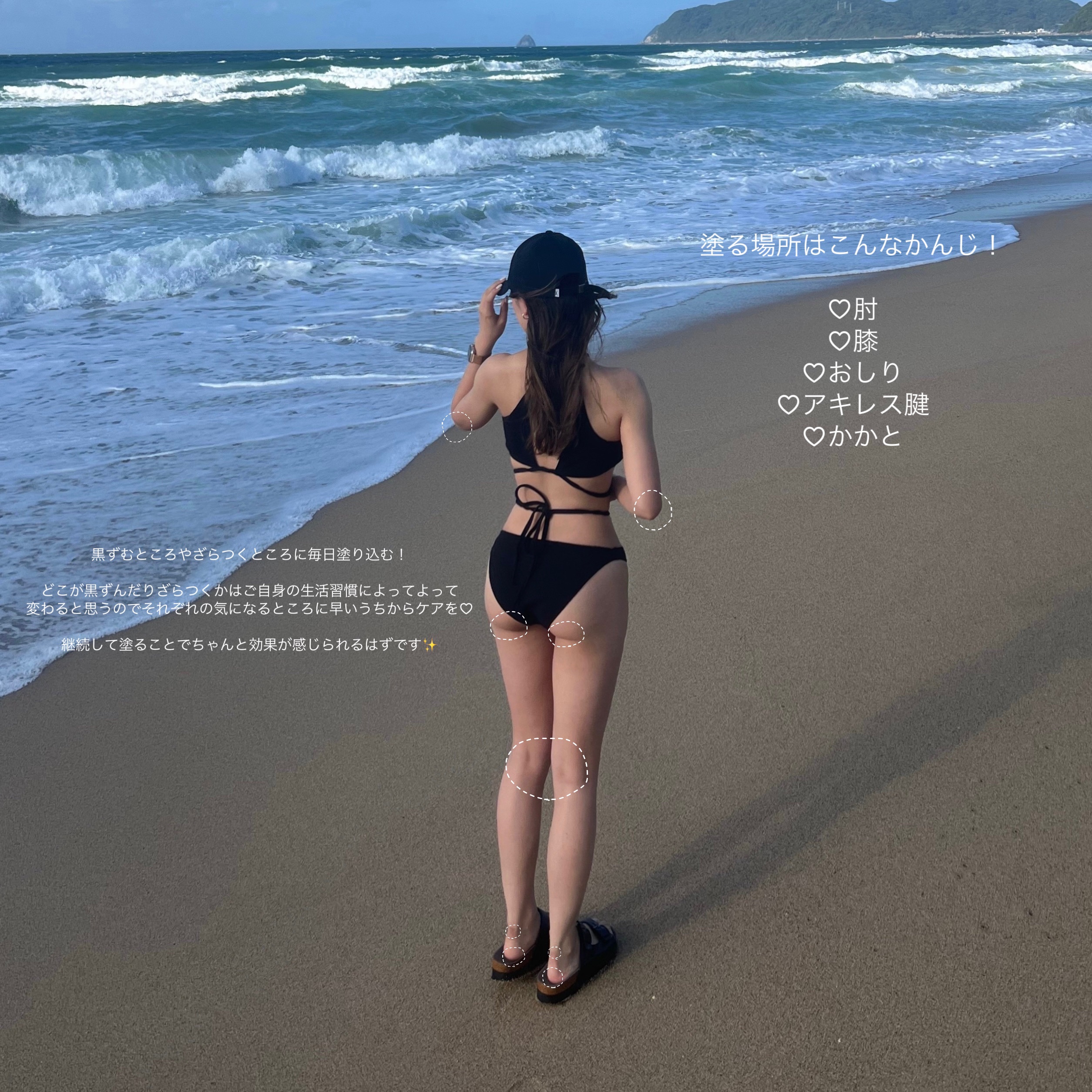 コーワ20％尿素配合クリーム(医薬品)/ケラチナミン/その他を使ったクチコミ（2枚目）