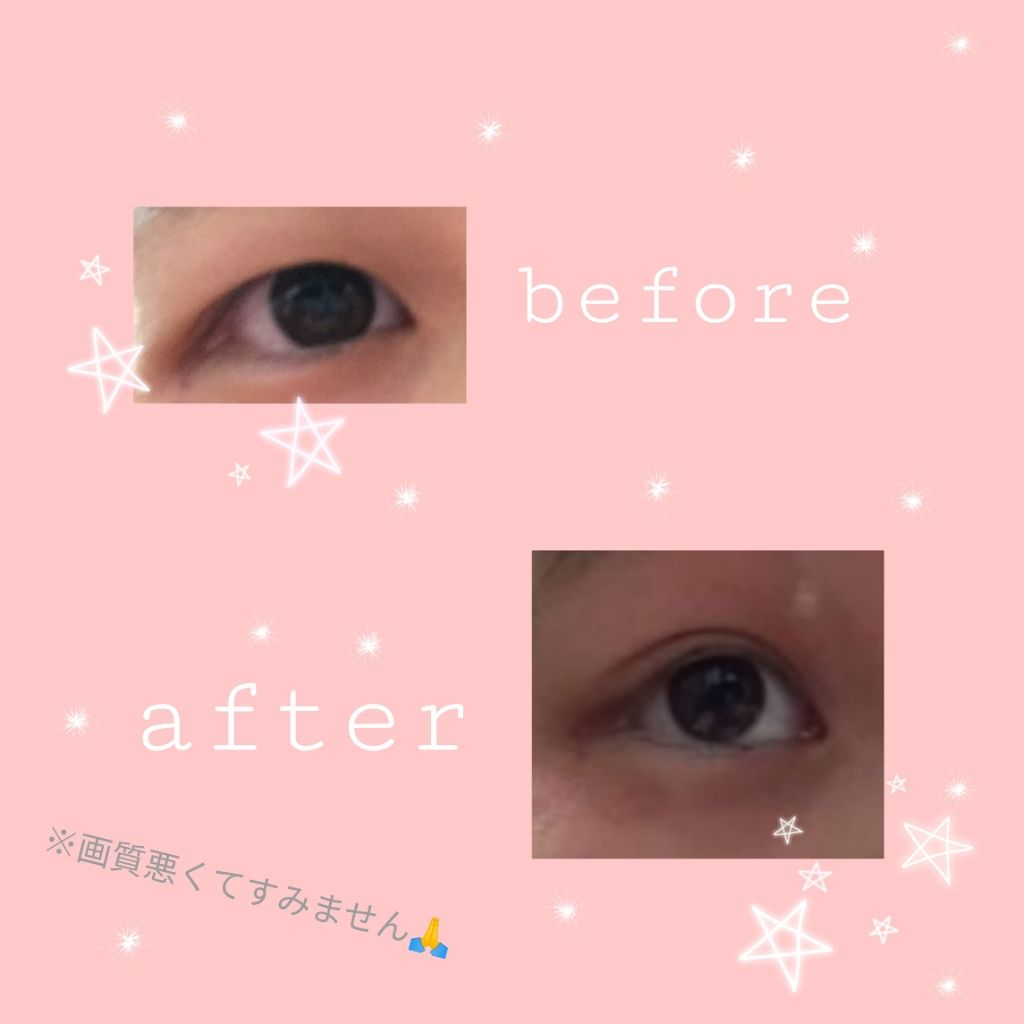 のびーるアイテープ（絆創膏タイプ、レギュラー）/DAISO/二重まぶた用アイテムを使ったクチコミ（2枚目）