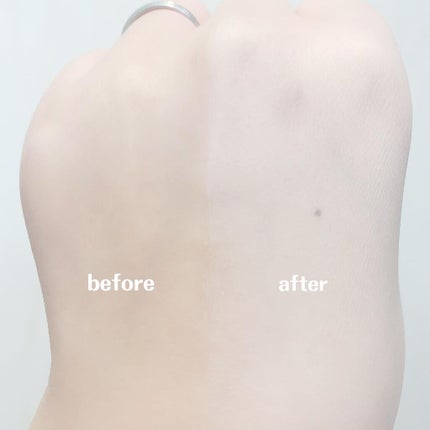 薬用ホワイトコンク ホワイトニングCC CII/ホワイトコンク/ボディクリームを使ったクチコミ(4枚目)