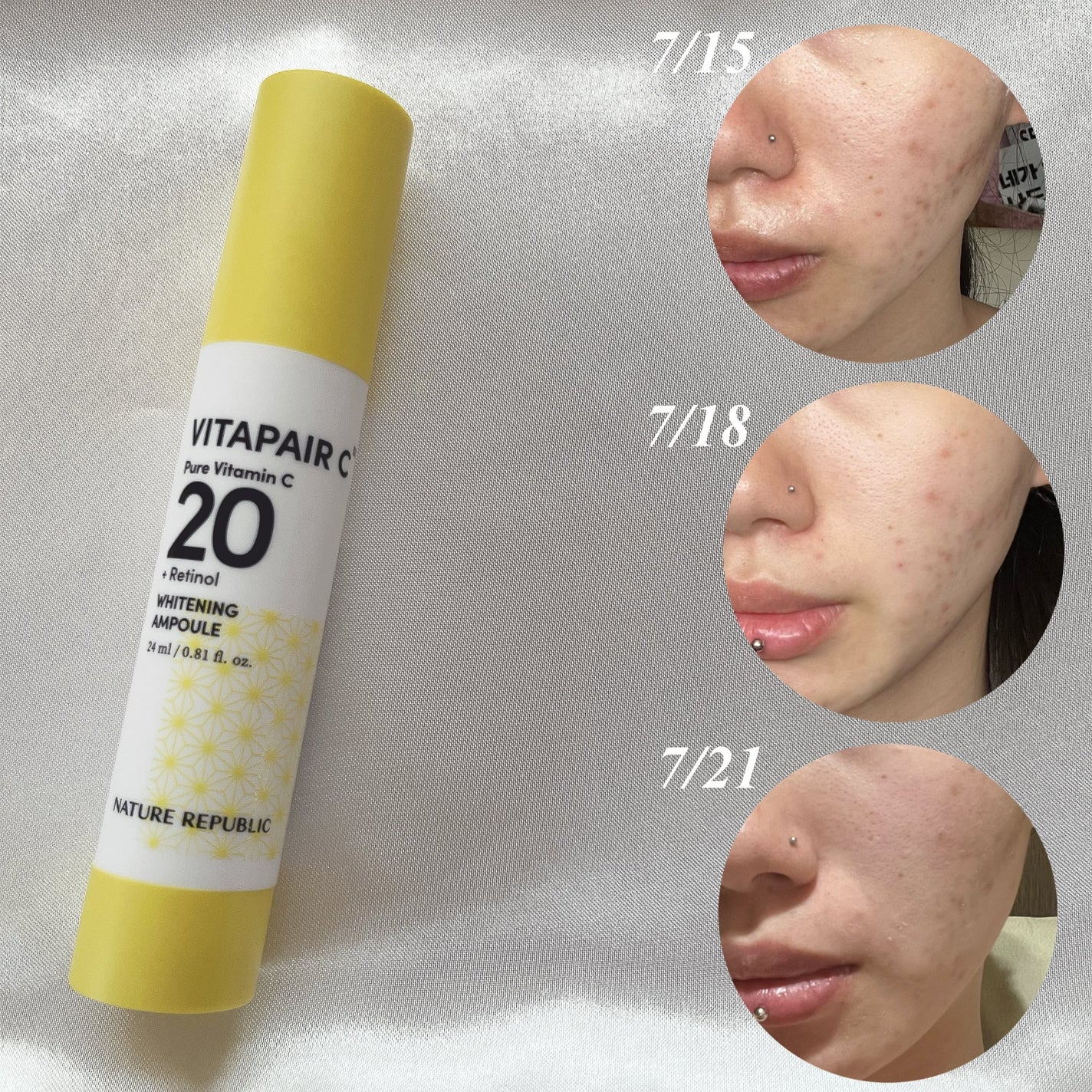 ビタペアC ビタレチ美容液/ネイチャーリパブリック/美容液を使ったクチコミ(2枚目)