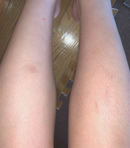 CONTRIBUTION Kmyu(ケミュー)のクチコミ「だんだんとあたたかくなってきて、半袖やスカート、ショーパンで肌見せをする機会も多くなってきまし.....」(3枚目)