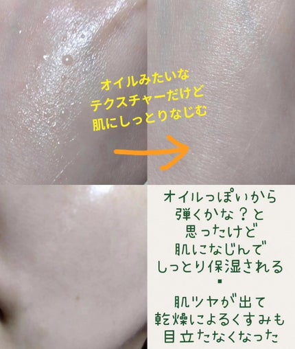 クラリフィック デュアル エッセンス ローション/LANCOME/化粧水を使ったクチコミ(3枚目)