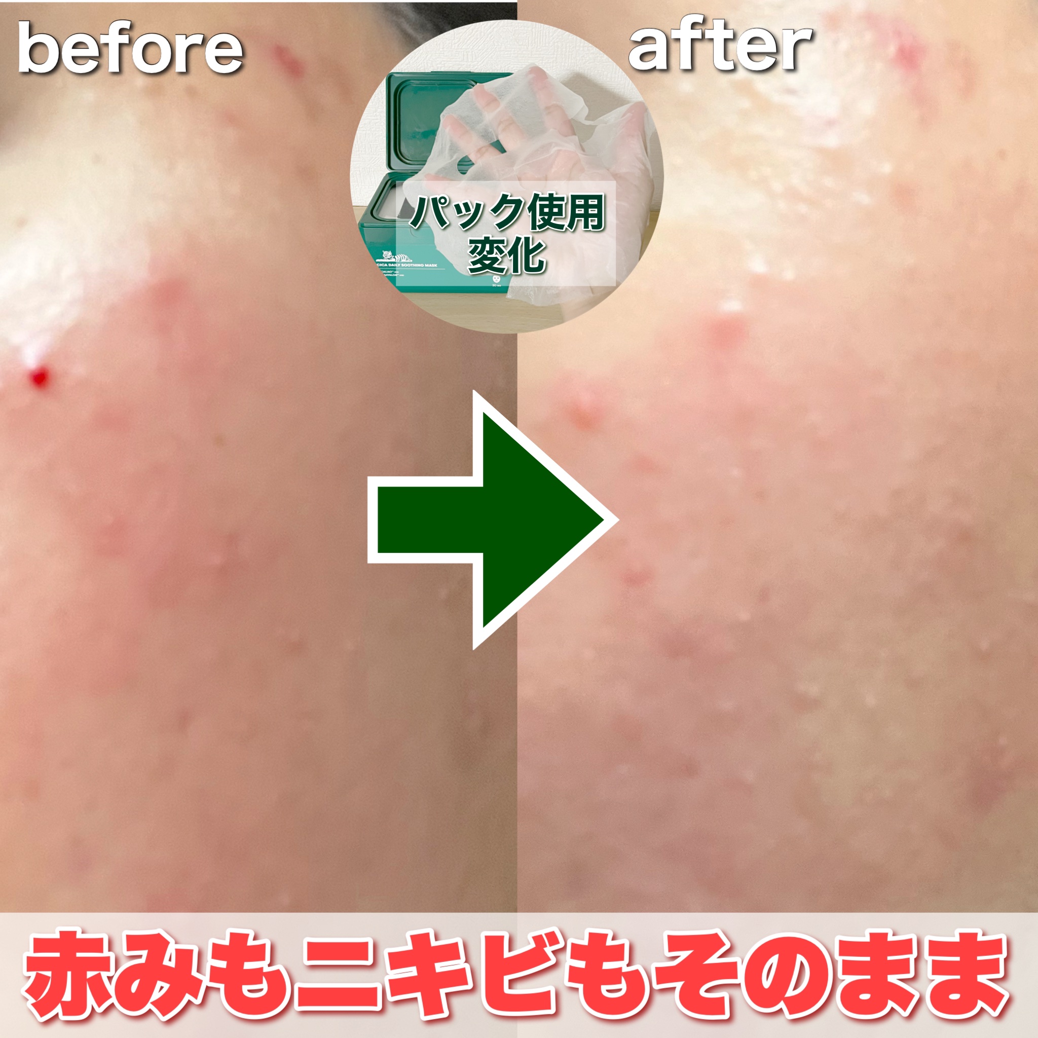 CICA デイリースージングマスク/VT/シートマスク・パックを使ったクチコミ（3枚目）