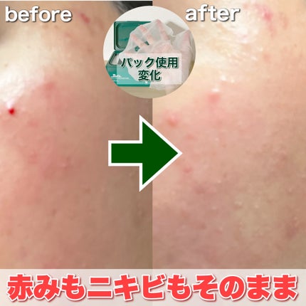 CICA デイリースージングマスク/VT/シートマスク・パックを使ったクチコミ(3枚目)