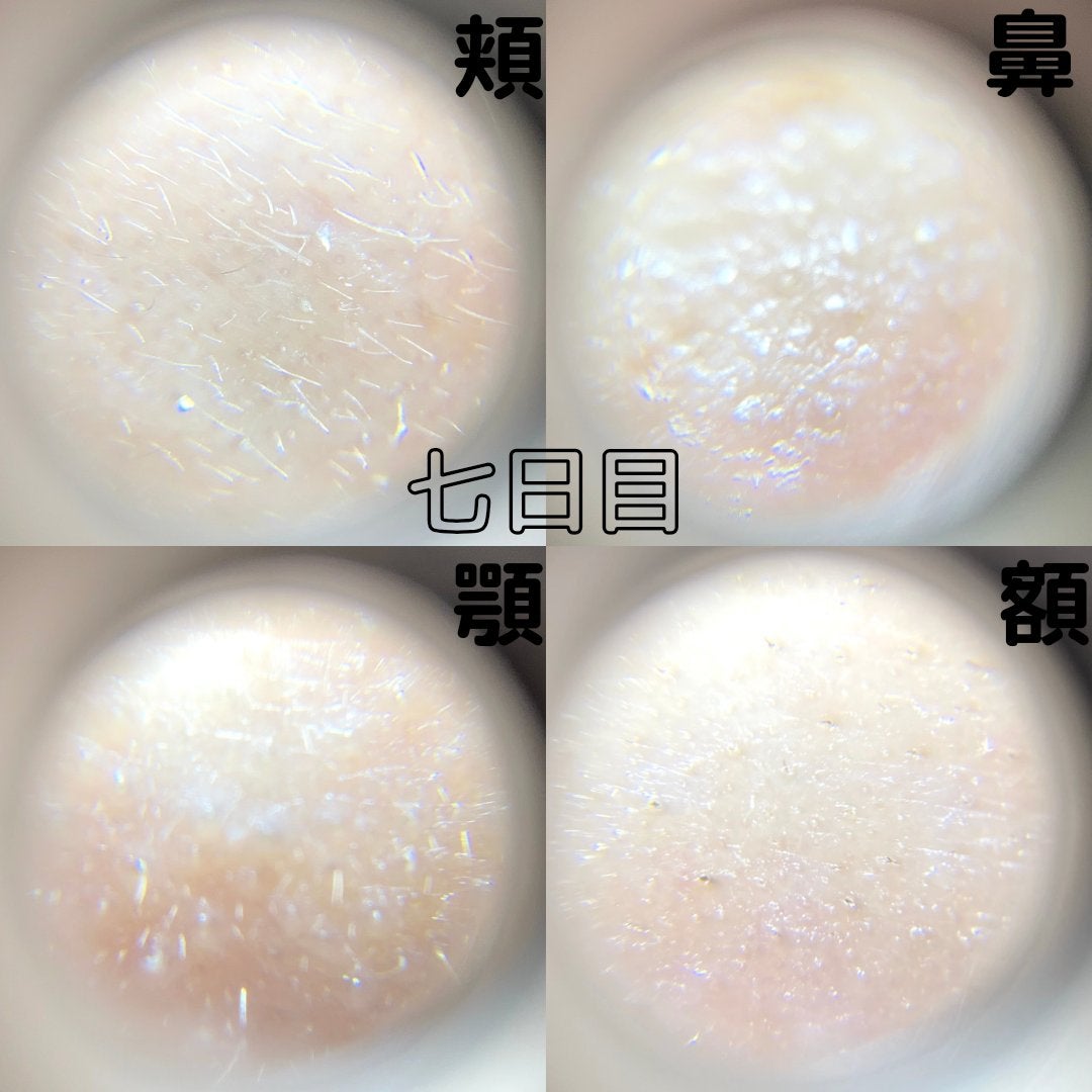 VITALIFT A forte/Dr.Different/フェイスクリームを使ったクチコミ(8枚目)