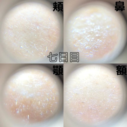 VITALIFT A forte/Dr.Different/フェイスクリームを使ったクチコミ(8枚目)