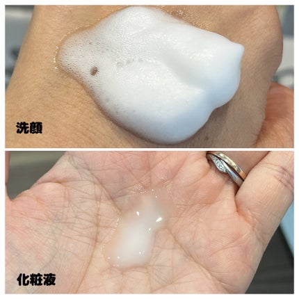 アトバリア365クリーム/AESTURA/フェイスクリームを使ったクチコミ(6枚目)