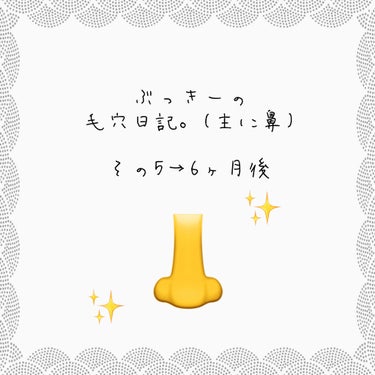 #ぶっきーと毛穴ケア　第5段投稿！忘れていた人も多いのではないでしょうか？何を隠そう私自身が忘れかけていました😂

そして今回beforeの初回撮影写真は、投稿を作成する度に自分で何度も目にして汚らわし