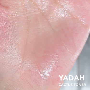 カクタス87%鎮静トナー/YADAH/化粧水を使ったクチコミ（5枚目）