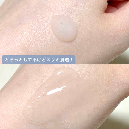 エイシカ365 ブレミッシュカーミングセラム/AESTURA/美容液を使ったクチコミ(4枚目)