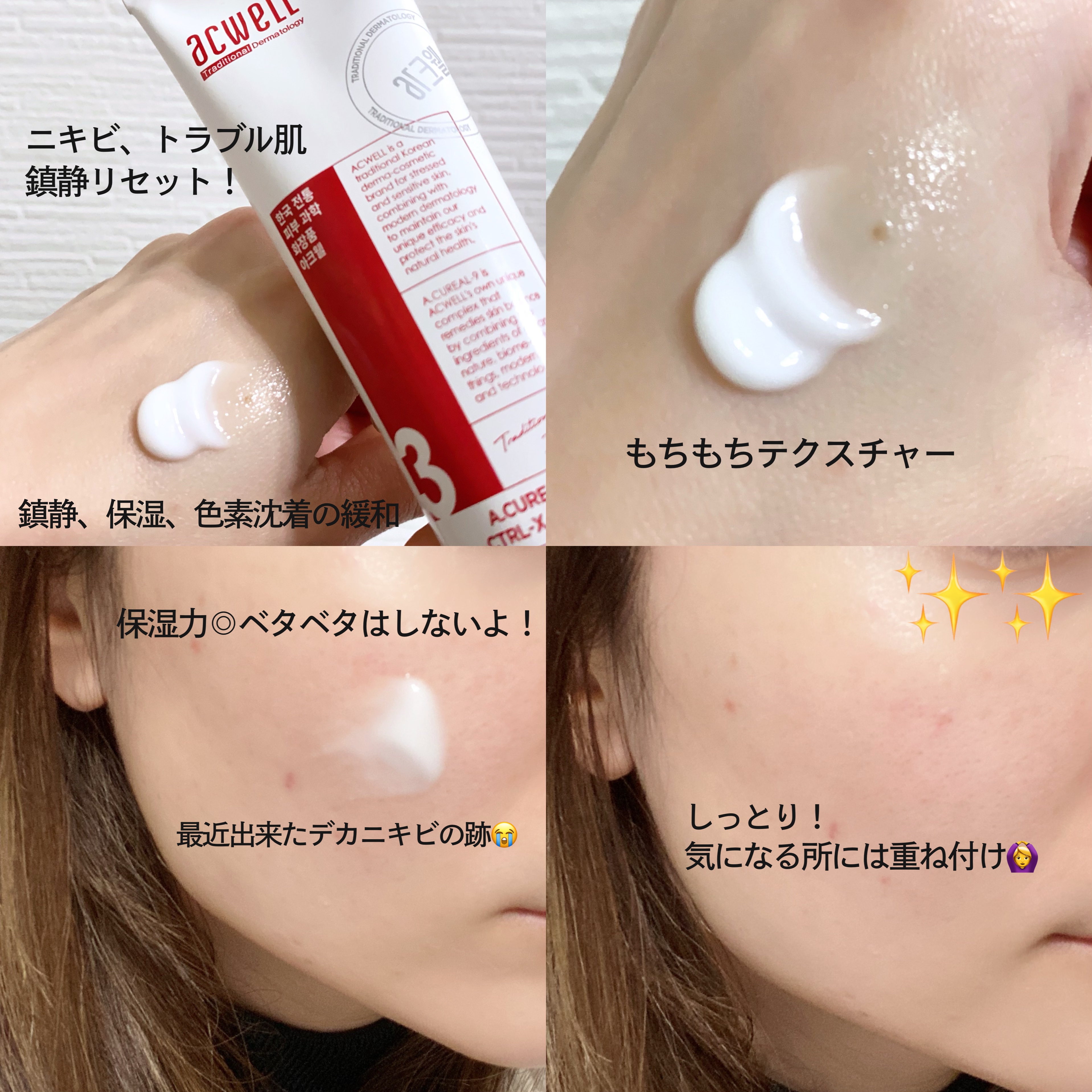 アキュリアルナインコントロールエックスクリーム/ACWELL/フェイスクリームを使ったクチコミ（2枚目）