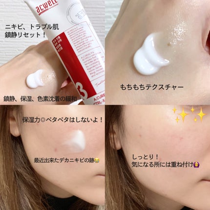 アキュリアルナインコントロールエックスクリーム/ACWELL/フェイスクリームを使ったクチコミ(2枚目)