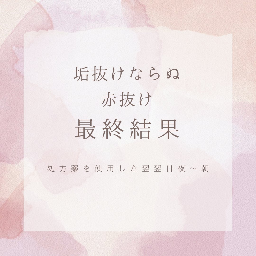 アミノウォッシングフォーム/KISO/化粧水を使ったクチコミ（1枚目）