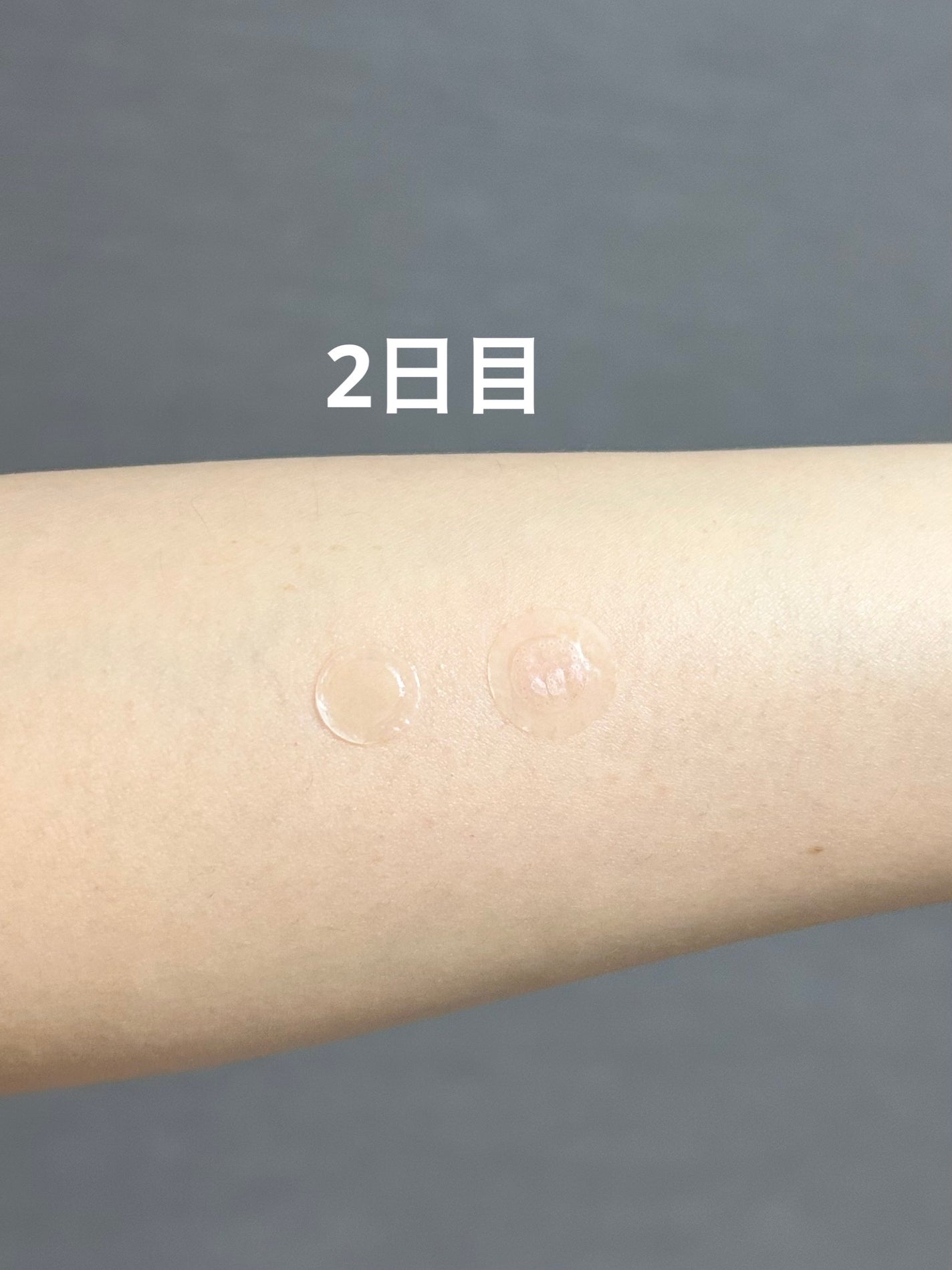 ビューティー スポットパッチ/イージーダムビューティー/にきびパッチを使ったクチコミ(3枚目)