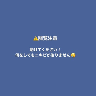 大人のニキビ対策 薬用美白化粧水/肌美精/化粧水を使ったクチコミ（1枚目）