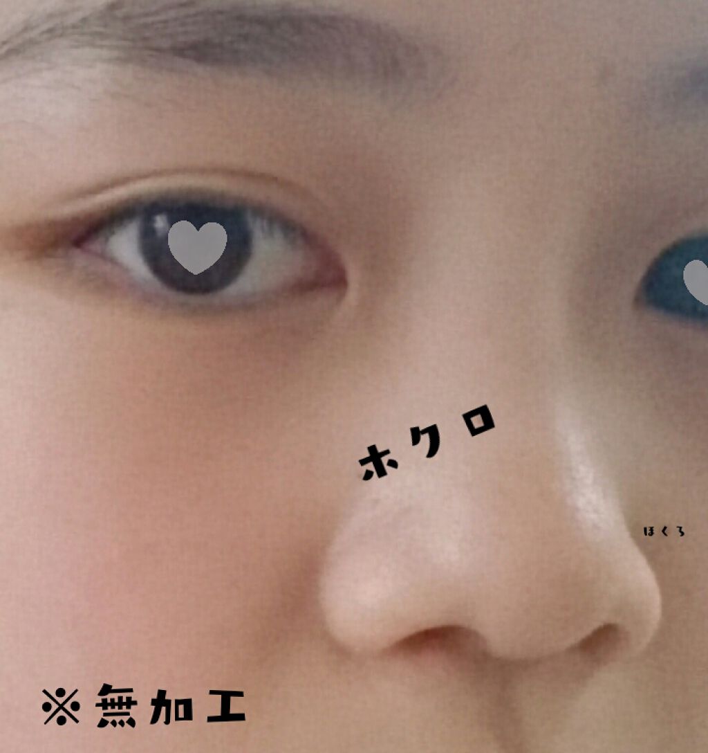 薬用保湿化粧水/オードムーゲ/化粧水を使ったクチコミ(2枚目)