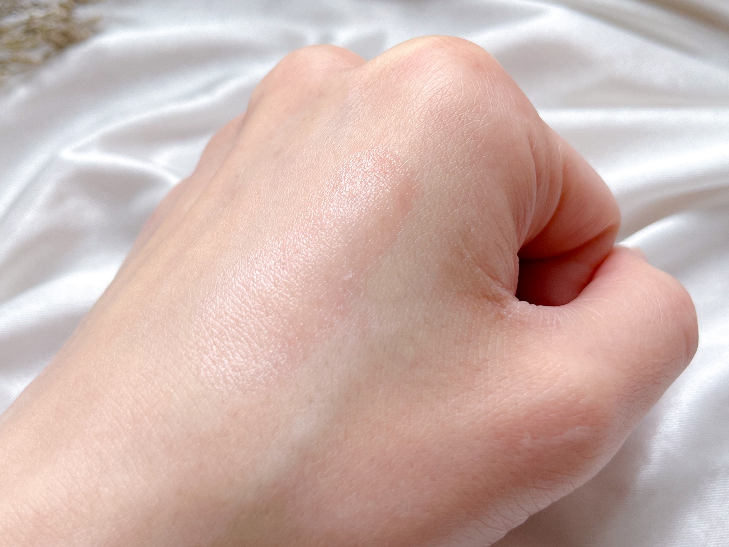 ティントリップレスキュー/FRESHO2/リップバームを使ったクチコミ（3枚目）