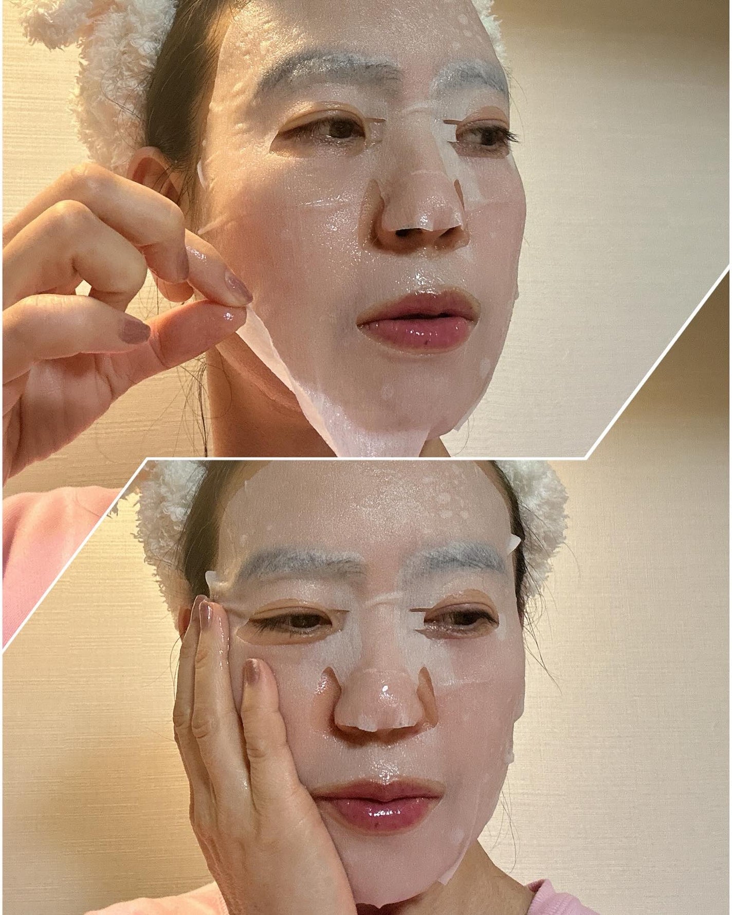 フラクショナルCC ニードルマスクC/fractionalCC/シートマスク・パックを使ったクチコミ(5枚目)