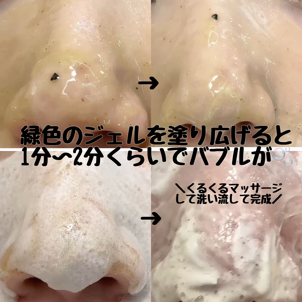 バイバイブラックヘッド グリーンティートックスバブルクレンザー/SOME BY MI/スクラブ・ゴマージュを使ったクチコミ（2枚目）