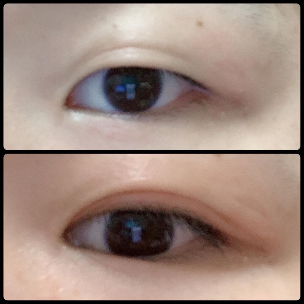 フタエキープ/水橋保寿堂製薬/二重まぶた用アイテムを使ったクチコミ(3枚目)