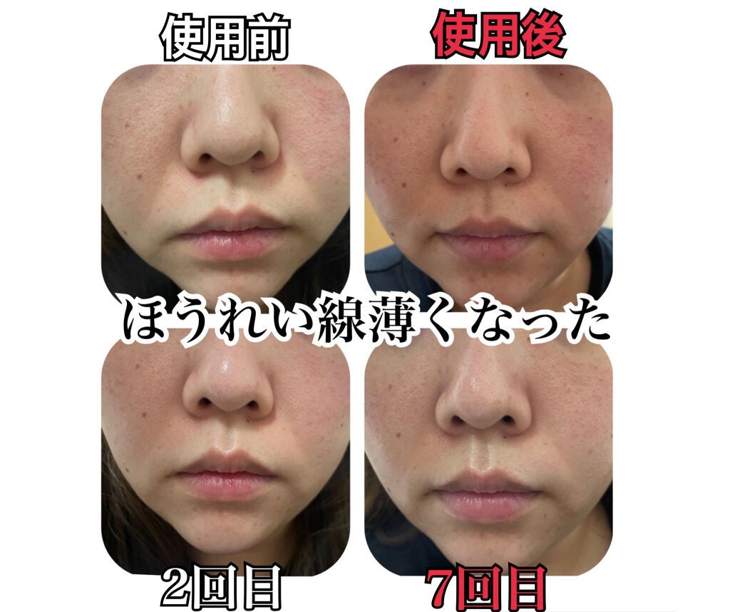 エリクシール シュペリエル エンリッチド リンクルクリーム/エリクシール/アイケア・アイクリームを使ったクチコミ(1枚目)