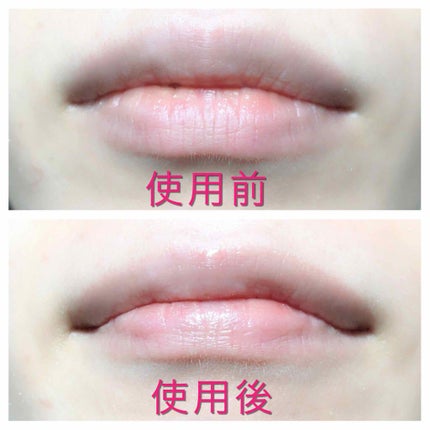 プロテクティブリップバーム ブロックスティック/Abib /リップバームを使ったクチコミ(3枚目)