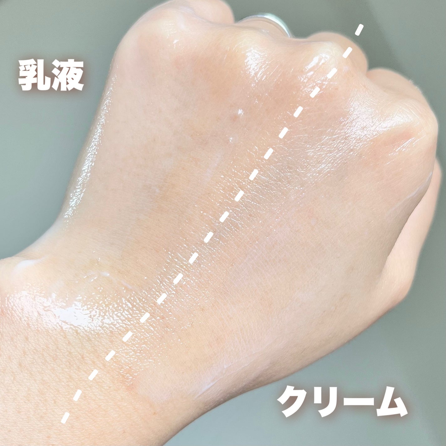 薬用高保湿化粧水/乾燥さん/化粧水を使ったクチコミ(4枚目)