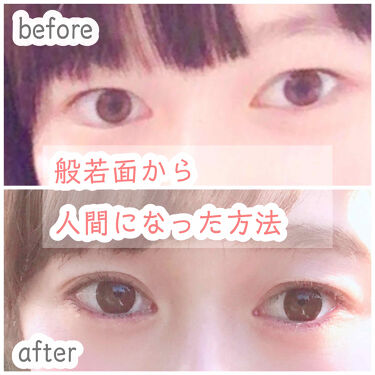 ナイトアイボーテ Streetrendの使い方を徹底解説 般若面から人間になった二重幅を広げる方法 By Tobibi 普通肌 代前半 Lips