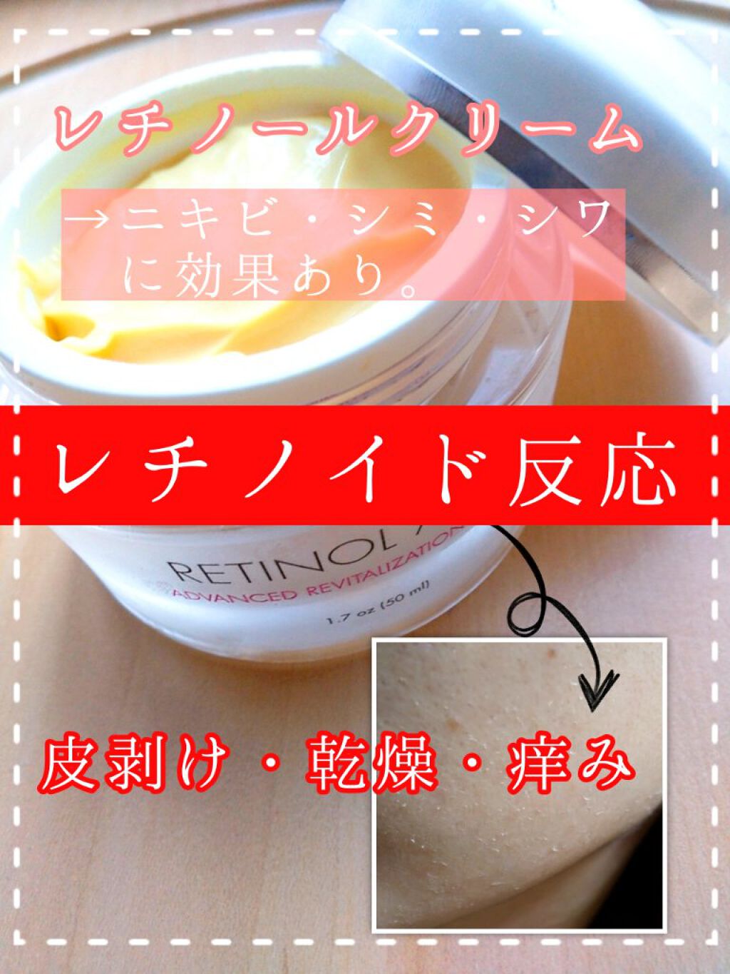 レチノールA 1% アドバンスドリバイタリゼーションクリーム/Life-flo/フェイスクリームを使ったクチコミ（1枚目）