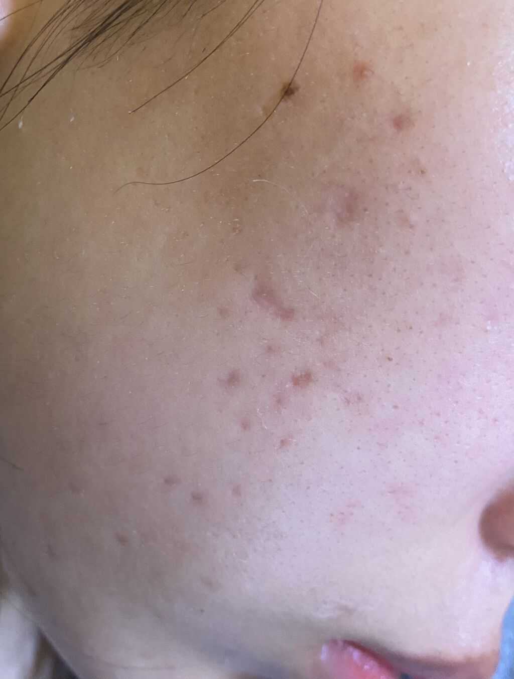 潤浸保湿 フェイスクリーム/キュレル/フェイスクリームを使ったクチコミ（2枚目）