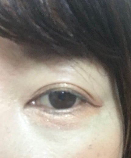 ホワイトニングエッセンス EX/Excellula/美容液を使ったクチコミ(4枚目)