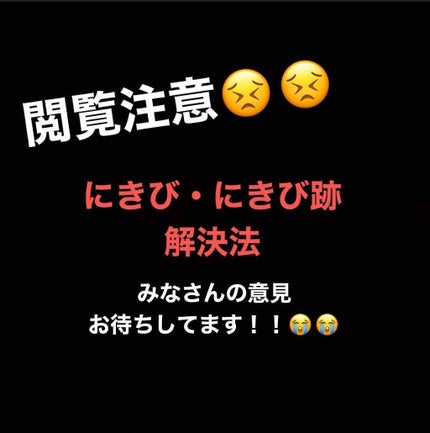ハトムギ化粧水(ナチュリエ スキンコンディショナー R )/ナチュリエ/化粧水を使ったクチコミ(1枚目)