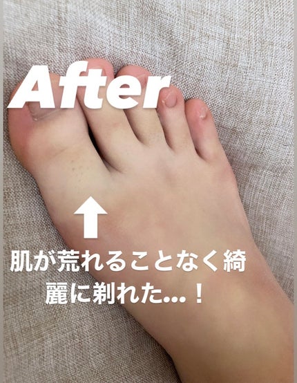 フェイス&ボディシェーバー KLC-0720 W/ホワイト/KOIZUMI/シェーバーの画像