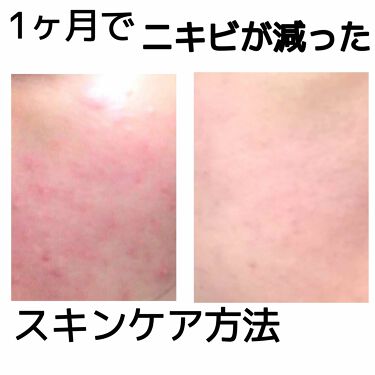 クラブ すっぴんパウダー クラブを使った口コミ 季節のせいなのか分かりませんが肌が真っ赤に By まかろなっち 敏感肌 代前半 Lips