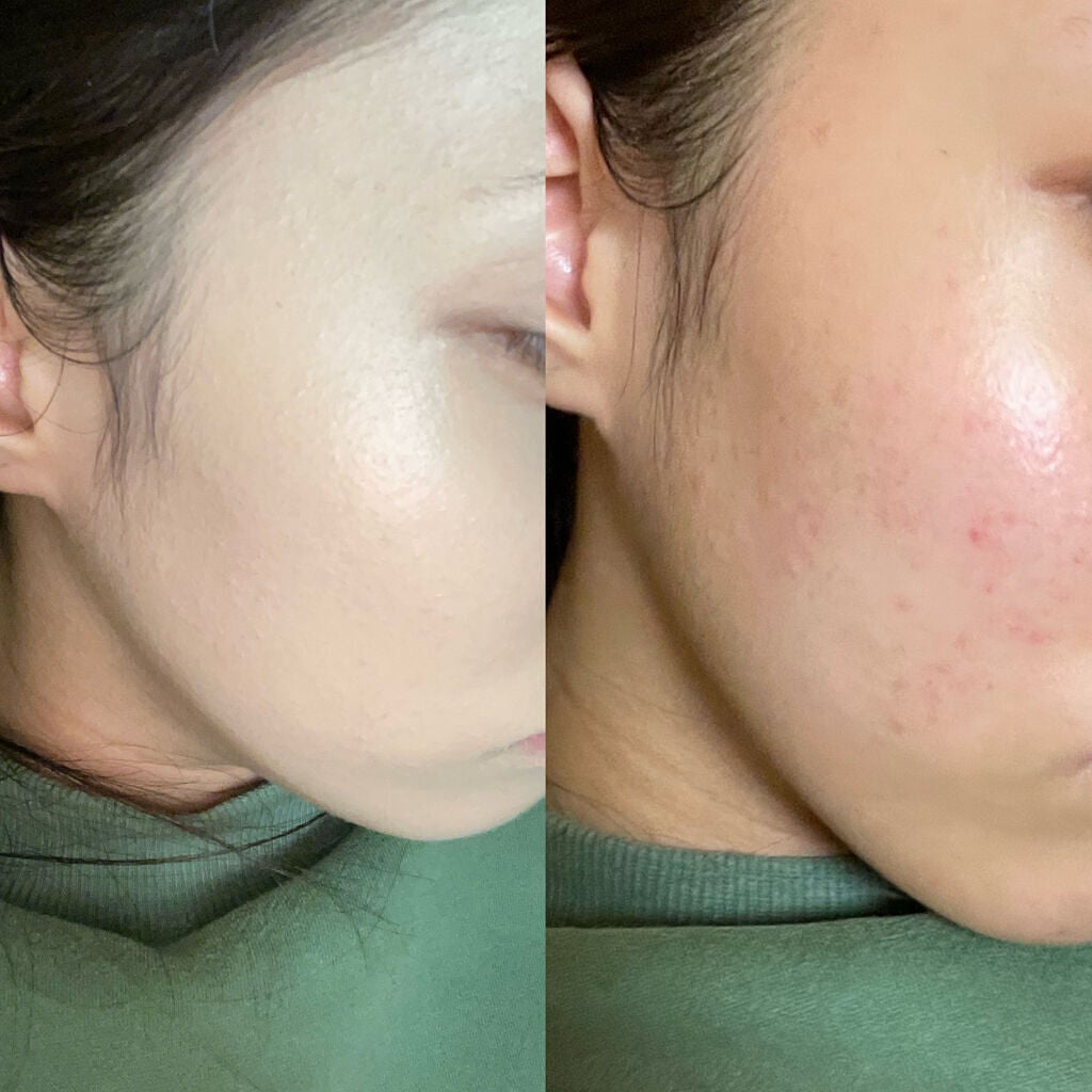 キル カバー アンプル クッション/CLIO/クッションファンデーションを使ったクチコミ(1枚目)