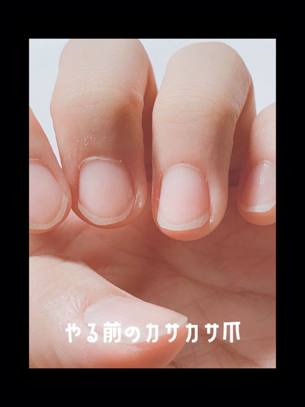 ネイルファンデーション/パラドゥ/マニキュアを使ったクチコミ（2枚目）