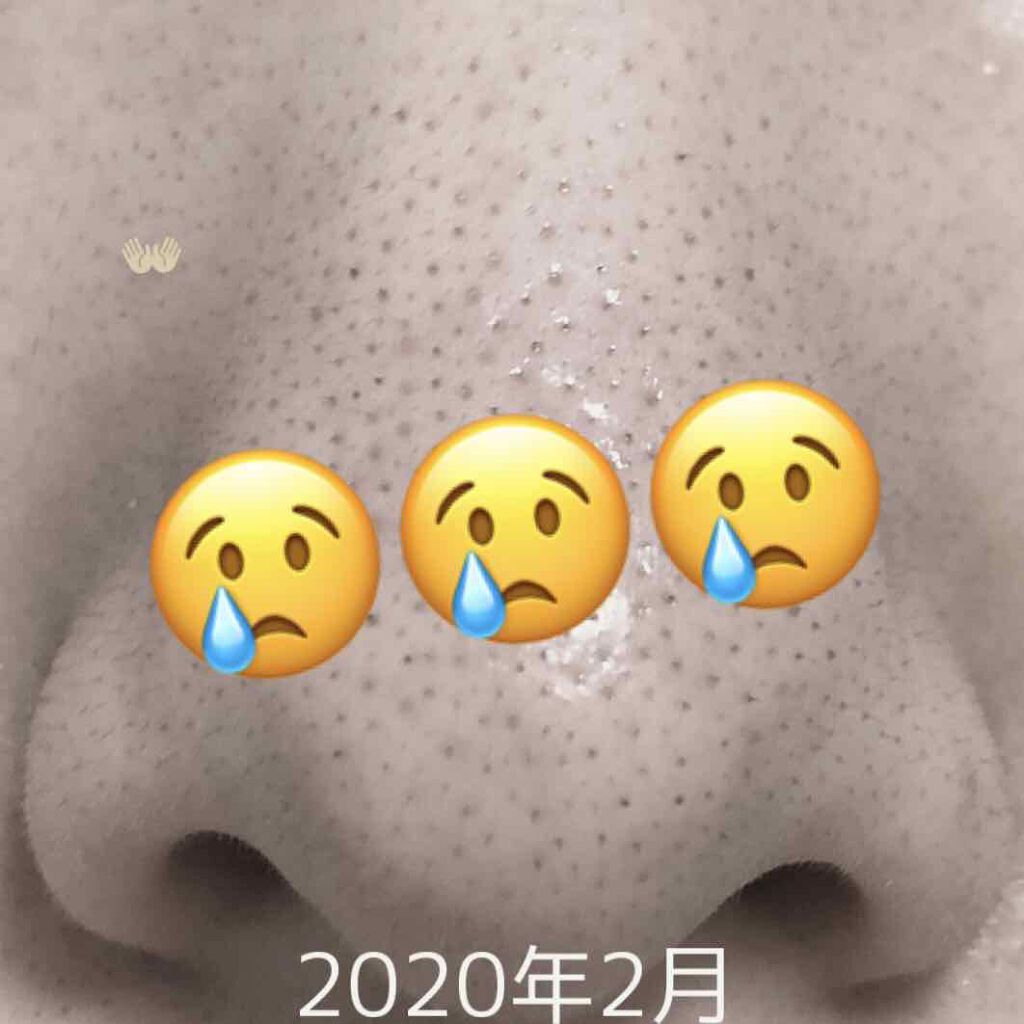 7 day Special Set プログラム4/b.glen/トライアルキットを使ったクチコミ(1枚目)