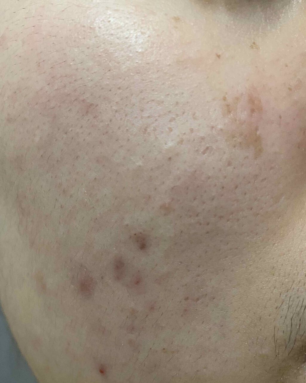 敏感肌用薬用美白美容液/無印良品/美容液を使ったクチコミ（2枚目）