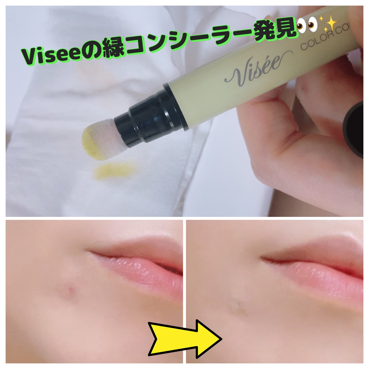 カラー コントローラー/Visée/リキッドコンシーラーを使ったクチコミ(1枚目)