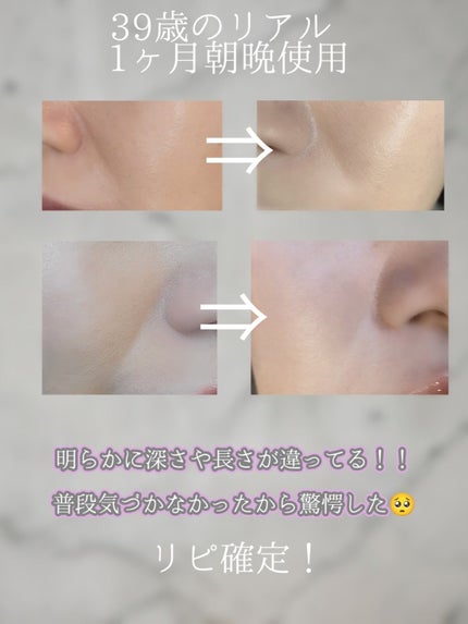 レチノパワー リンクルクリーム /エリクシール/アイケア・アイクリームを使ったクチコミ(4枚目)