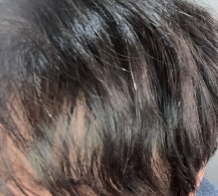 うるモイストインテンシブオイルセラム/byTREES/美容液を使ったクチコミ(5枚目)