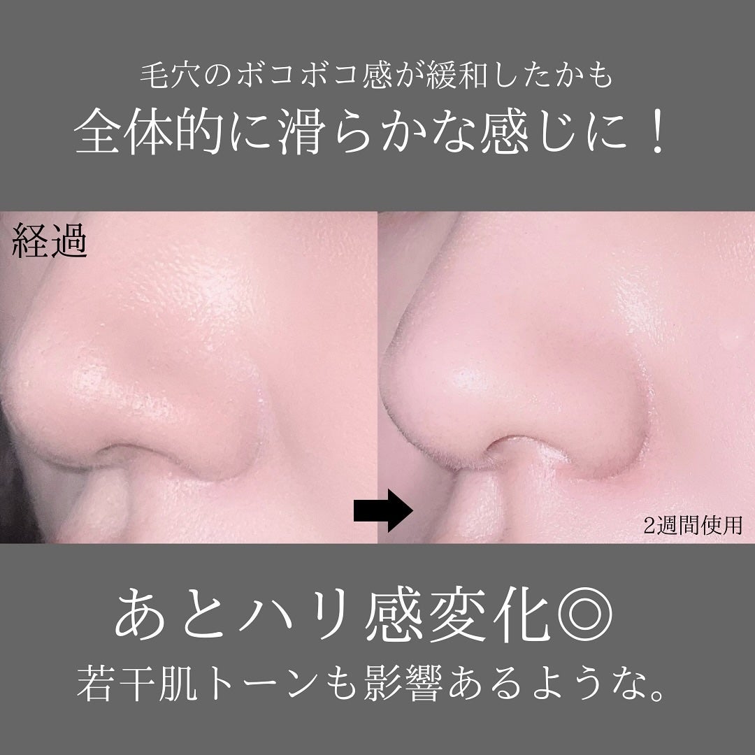 131 ポア クリアリング セラム/Celladix/美容液を使ったクチコミ(5枚目)