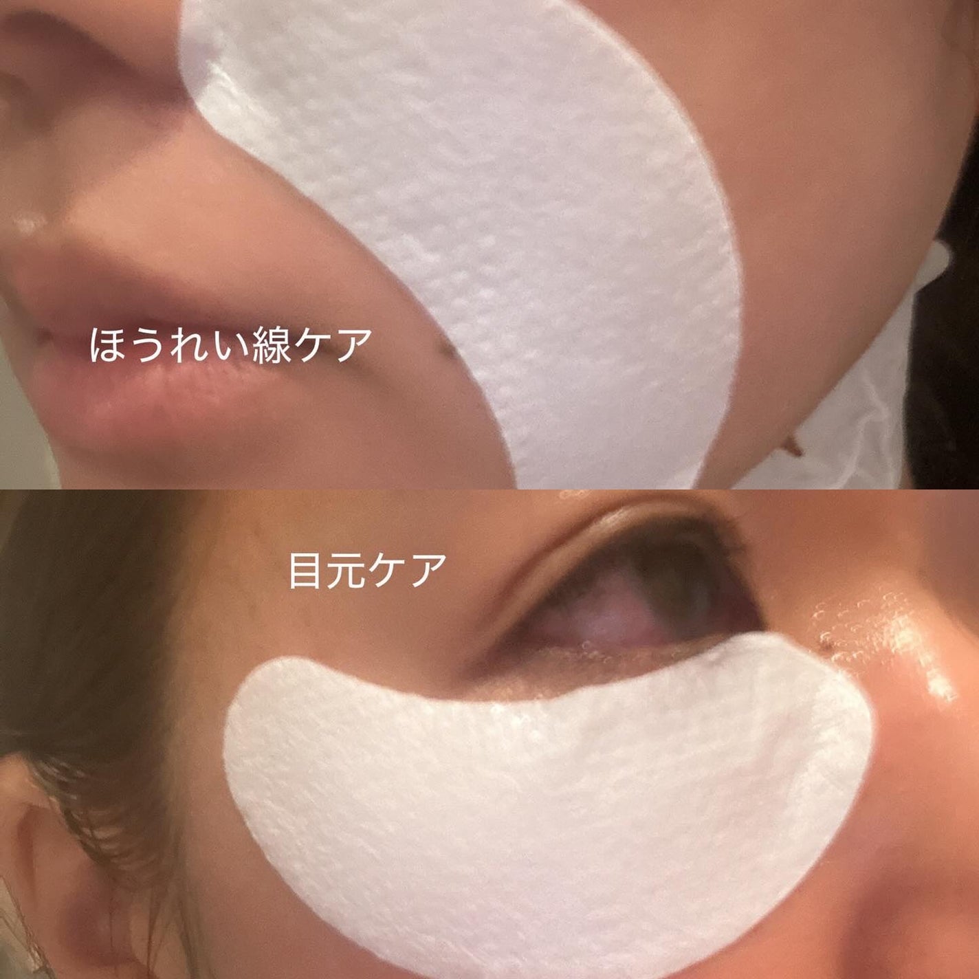 RTXペプチショットネックパッチ/Dr.G/シートマスク・パックを使ったクチコミ(5枚目)