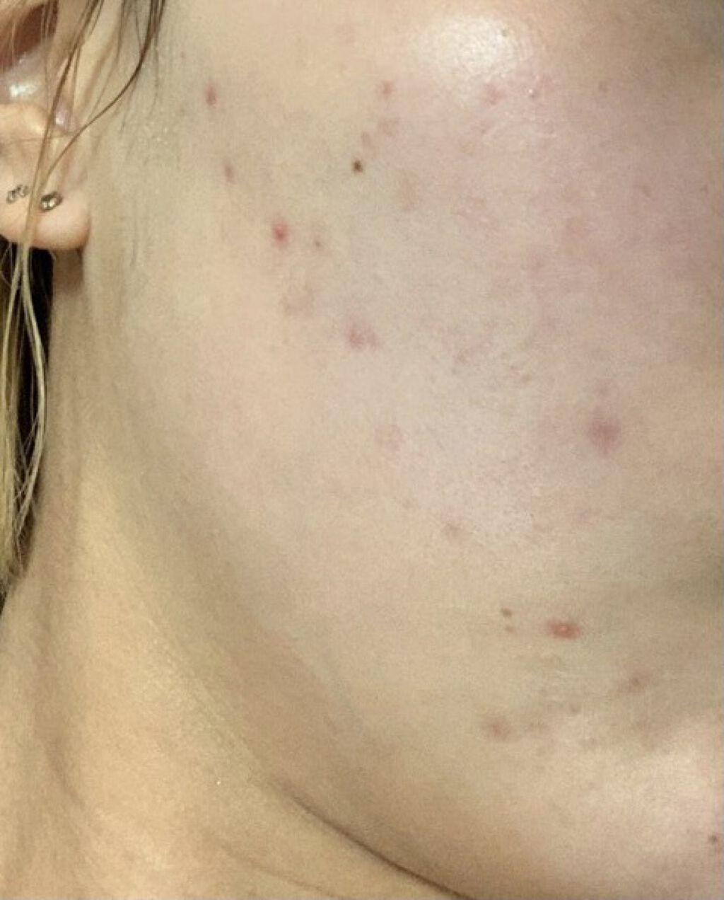 クリスタルパウダー/TOUT VERT/その他スキンケアを使ったクチコミ（1枚目）