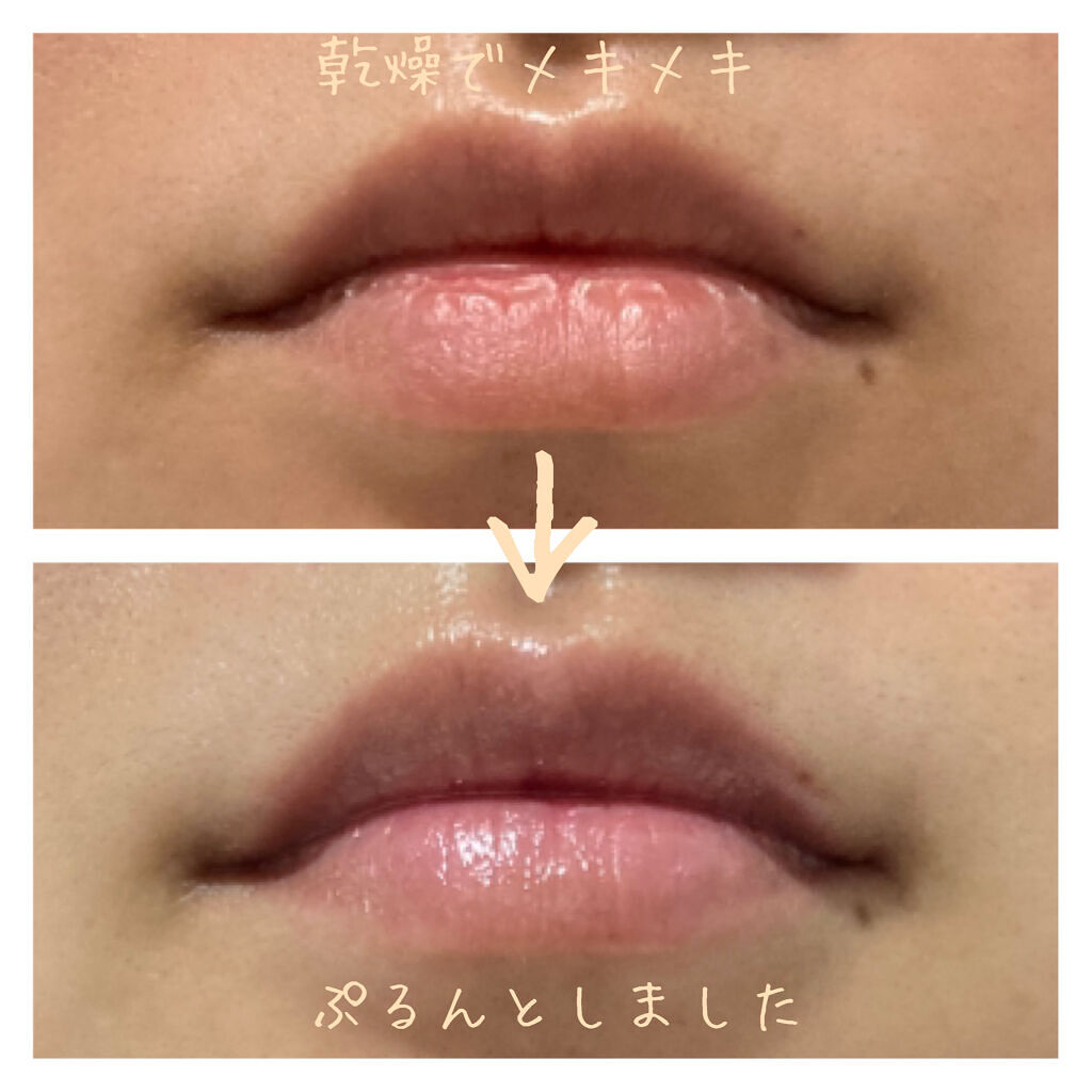 リップトリートメントバーム/LANEIGE/リップケアを使ったクチコミ（3枚目）