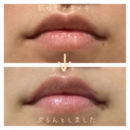 リップトリートメントバーム/LANEIGE/リップケアを使ったクチコミ(3枚目)