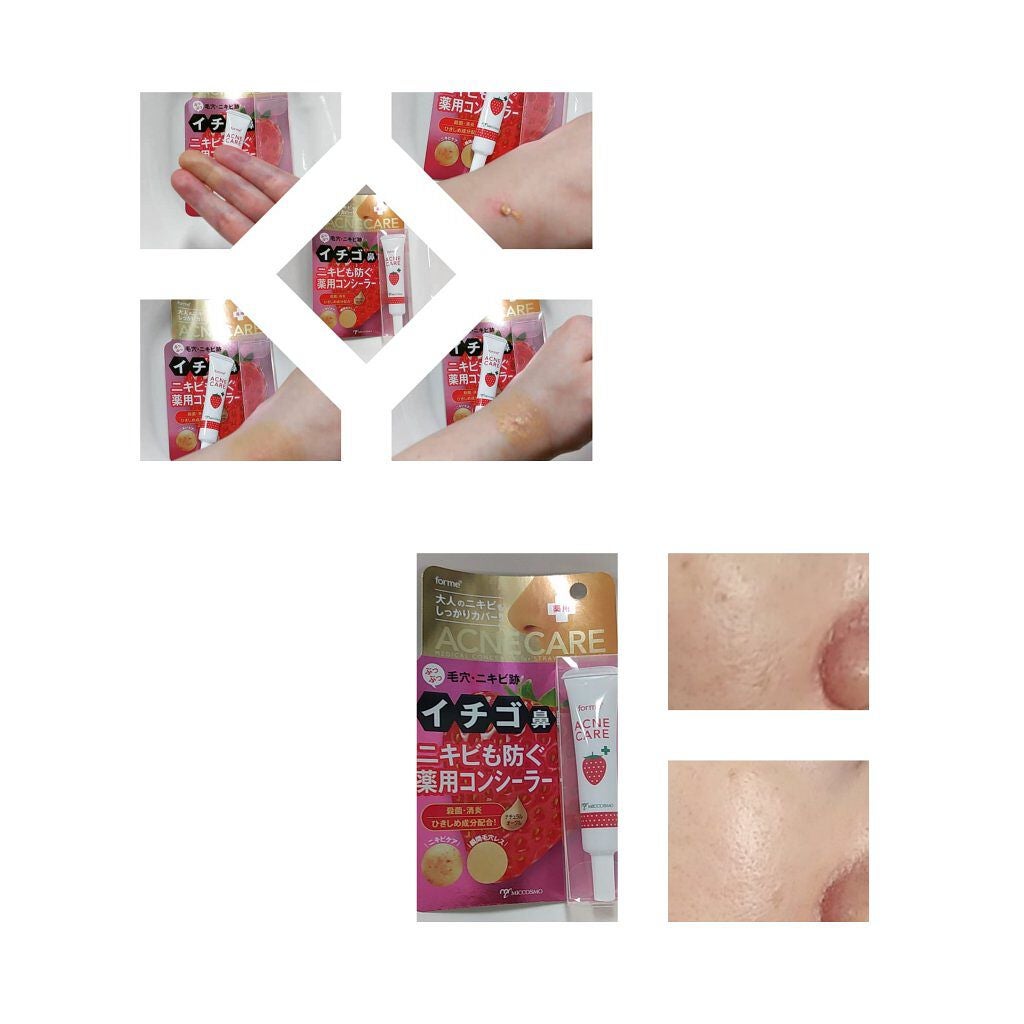 イチゴ鼻消し薬用コンシーラー/フォーミィ/リキッドコンシーラーを使ったクチコミ(1枚目)