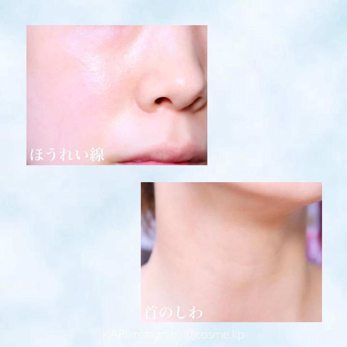 KAPI on LIPS 「\美容大国・韓国で生まれた目元専用エイジングケア/ANACIS..」(4枚目)