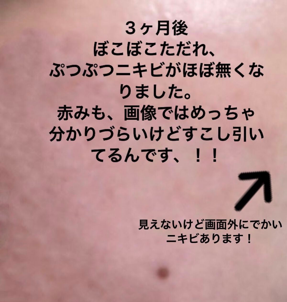 CICA クリーム/VT/フェイスクリームを使ったクチコミ(4枚目)