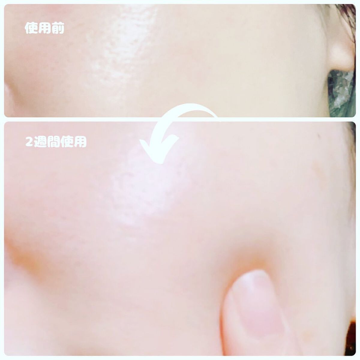 SANA☆*°フォロバ100 on LIPS 「美しさと元気のためのオールインワンサプリメント《燕の巣JELL..」(6枚目)